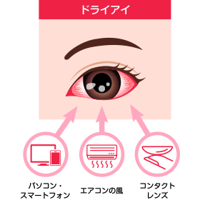 ドライアイの原因