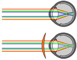 青色光線の色収差と、ハイドレンズの補正